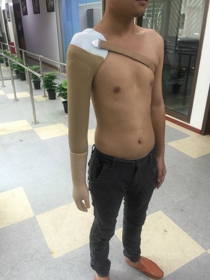 上臂美观手