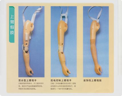 上臂假肢