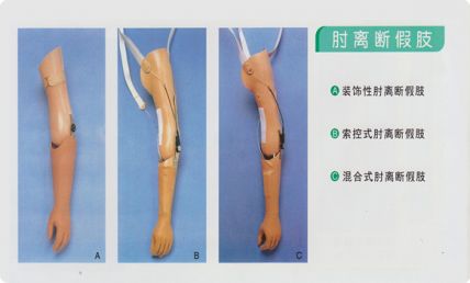 肘关节假肢